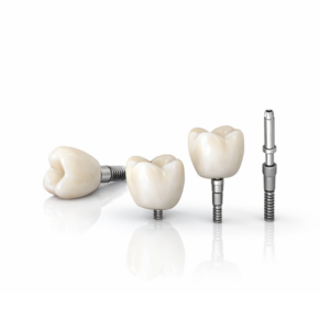 Festsitzender Zahnersatz - Mini Implantate