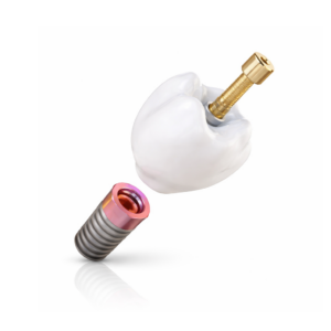 Festsitzender Zahnersatz - TRI matrix® Zahnkronen - Aus Zirkonoxid, NE-Metalle (Chrom-Kobalt) und Polymere wie PMMA