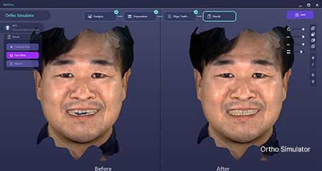 RayFace Software 5